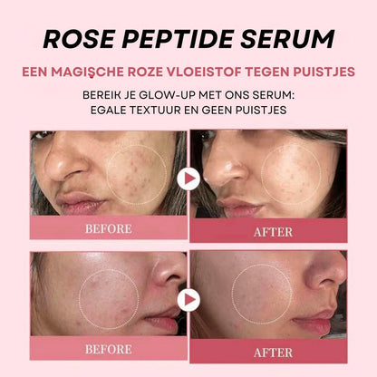 Rose Peptide Serum met PDRN