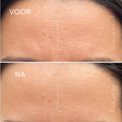 Koreaans Bio-Collageen Masker + Kwast