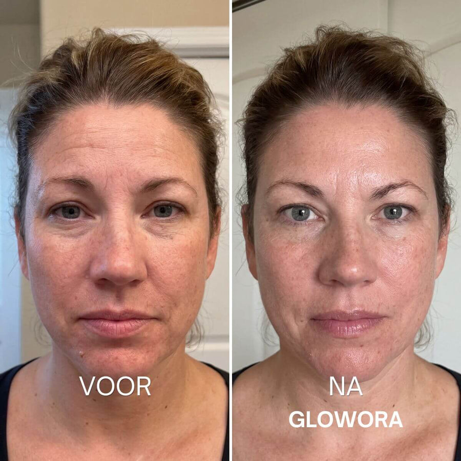 Geeft je huid direct een vollere, strakkere uitstraling