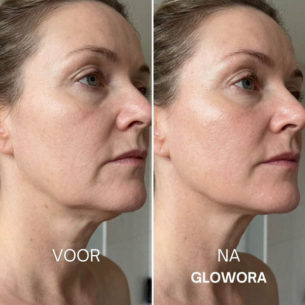 Fijne lijntjes rondom de lippen