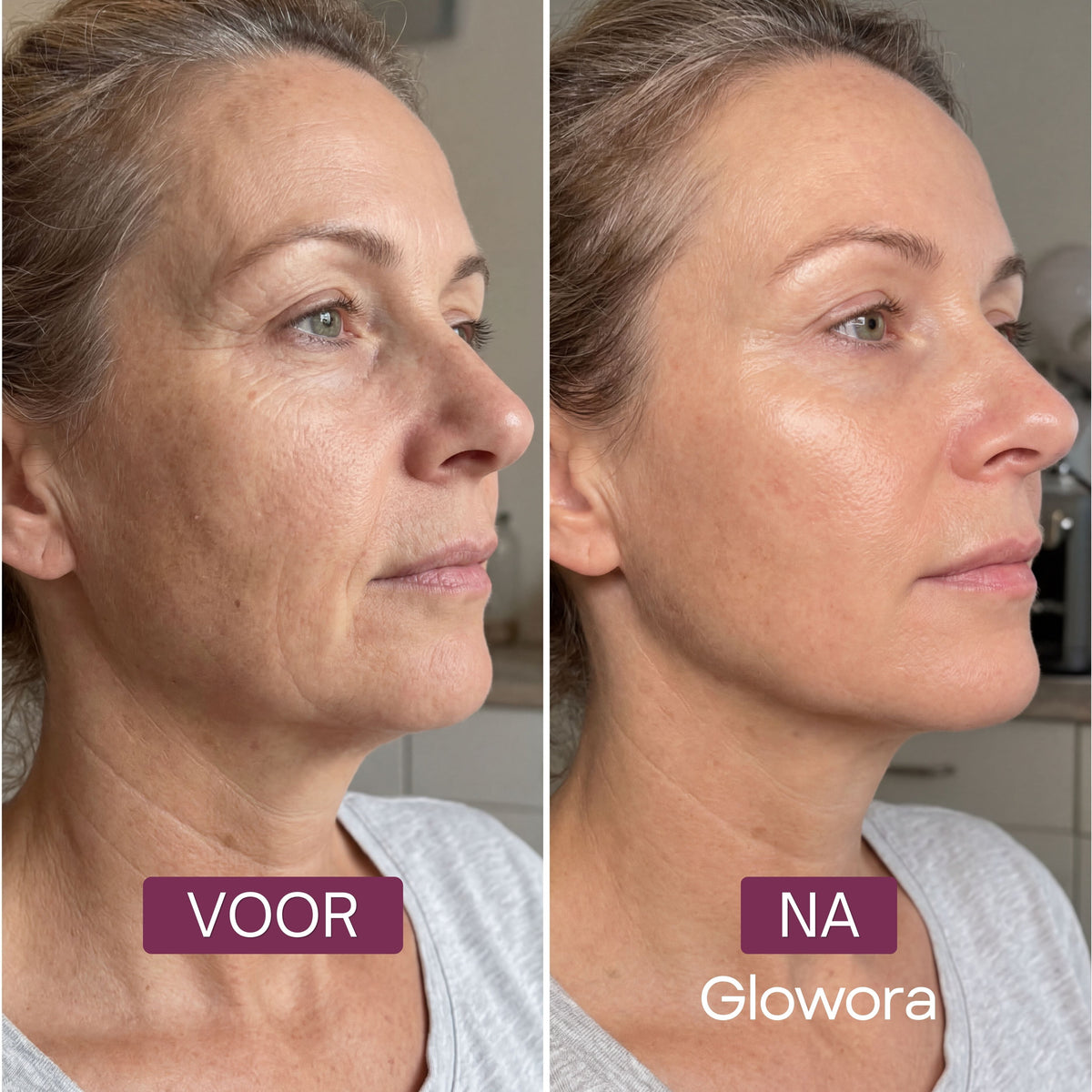 Voor-en-na zijaanzicht van een vrouw na gebruik van het Collageen Wrapping Masker