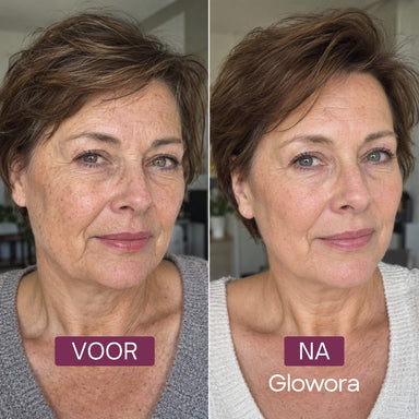 Voor-en-na foto van een vrouw met kort haar na gebruik van de Kojic Acid Pads