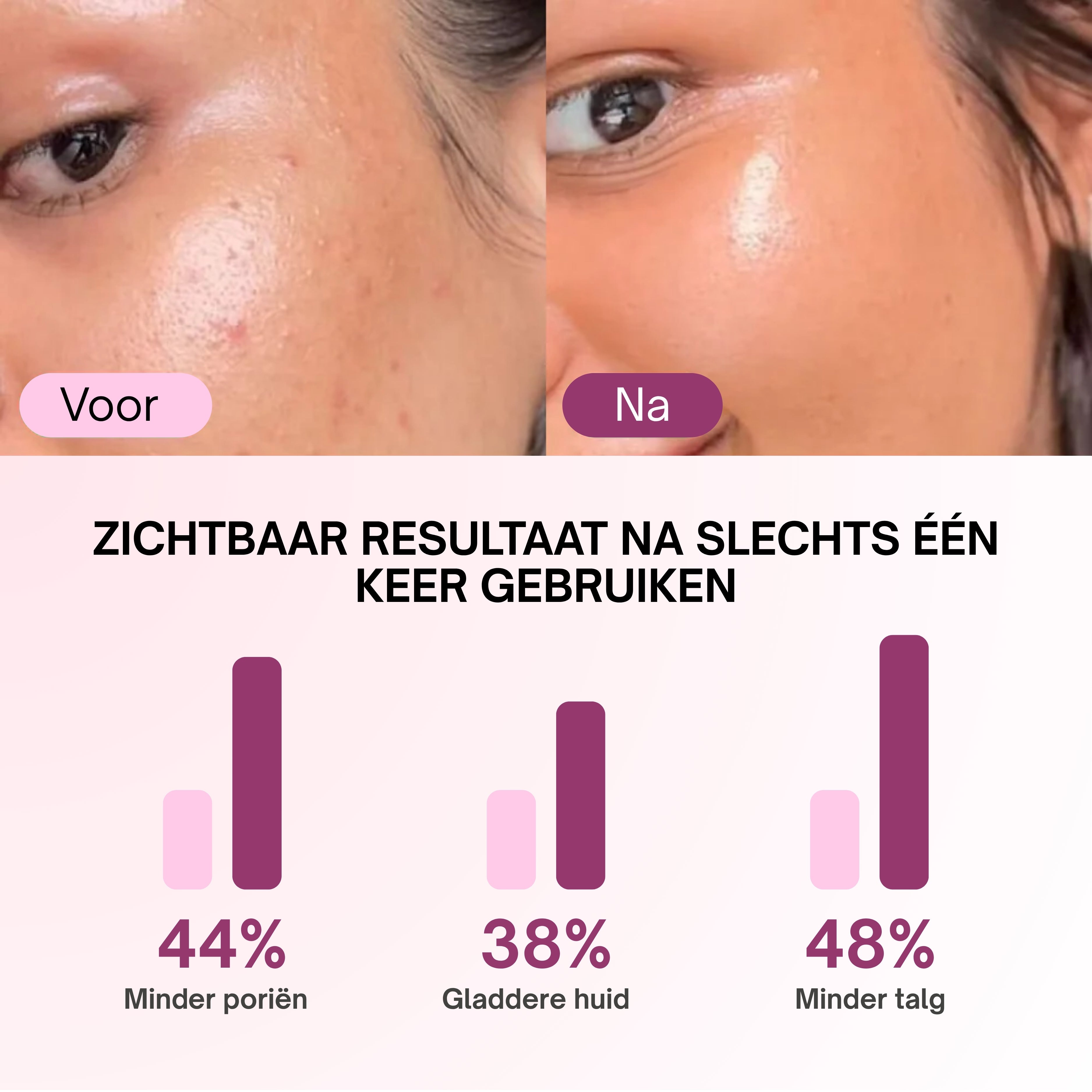 Zero Pore Pads