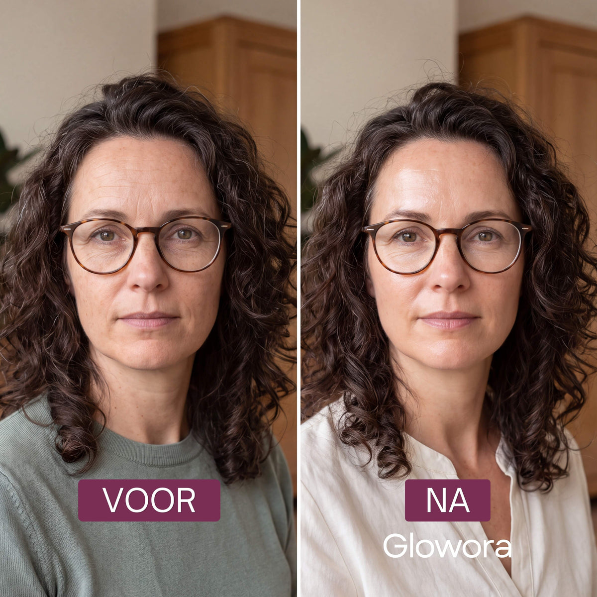 Voor-en-na foto van een vrouw met krullend haar na gebruik van het PDRN Peptide Serum