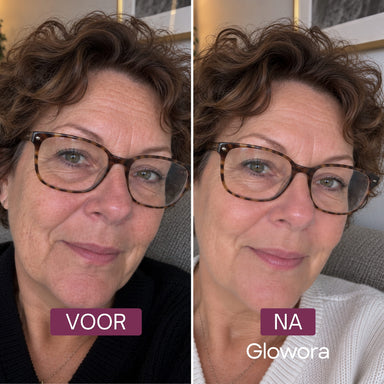 Voor-en-na foto van een vrouw met bril na gebruik van het Bakuchiol Peptide Serum