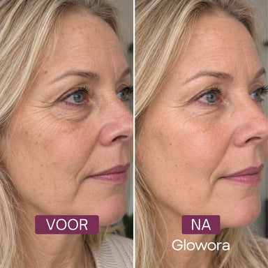 Voor-en-na zijaanzicht van de ogen van een vrouw na gebruik van de PDRN Peptide Oog Crème