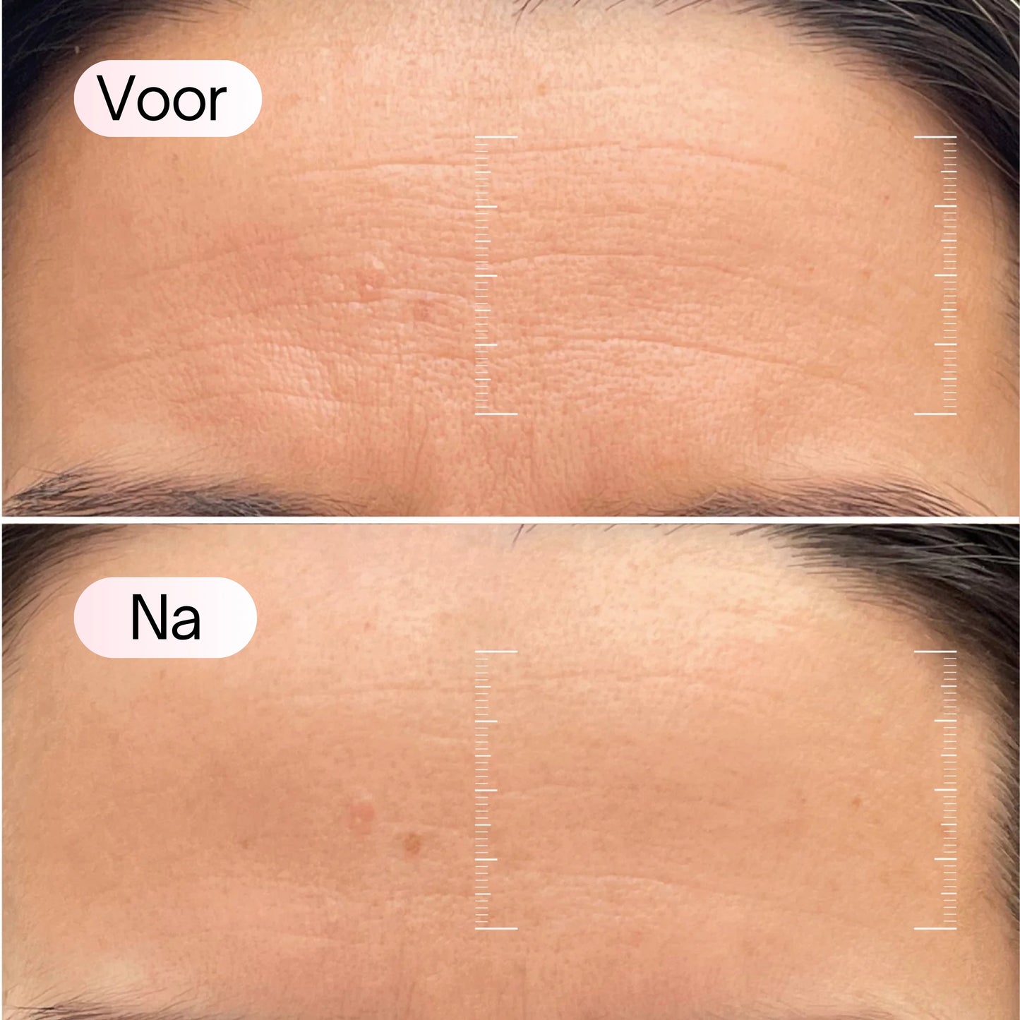 Bio-Collageen Masker + Kwast