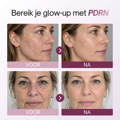 Twee voor-en-na resultaten van vrouwen na gebruik van het PDRN Peptide Serum