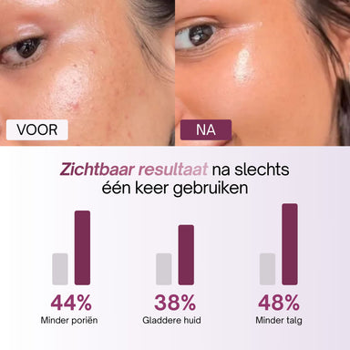 Voor-en-na huid met grafiek van resultaten na eenmalig gebruik van de Kojic Acid Pads