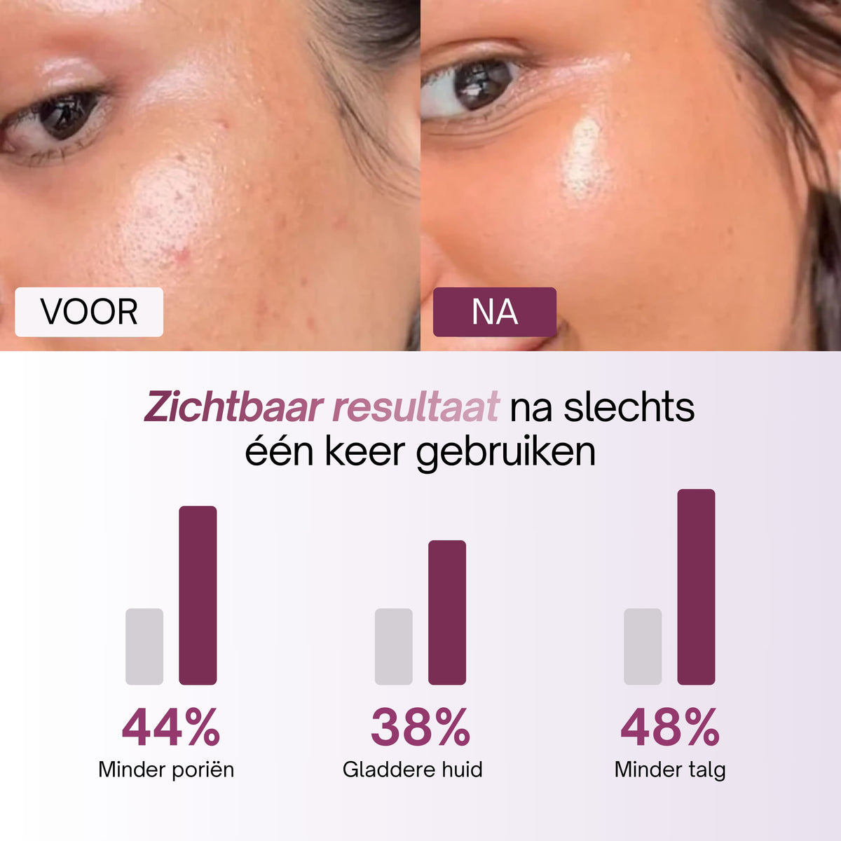 Voor-en-na huid met grafiek van resultaten na eenmalig gebruik van de Kojic Acid Pads