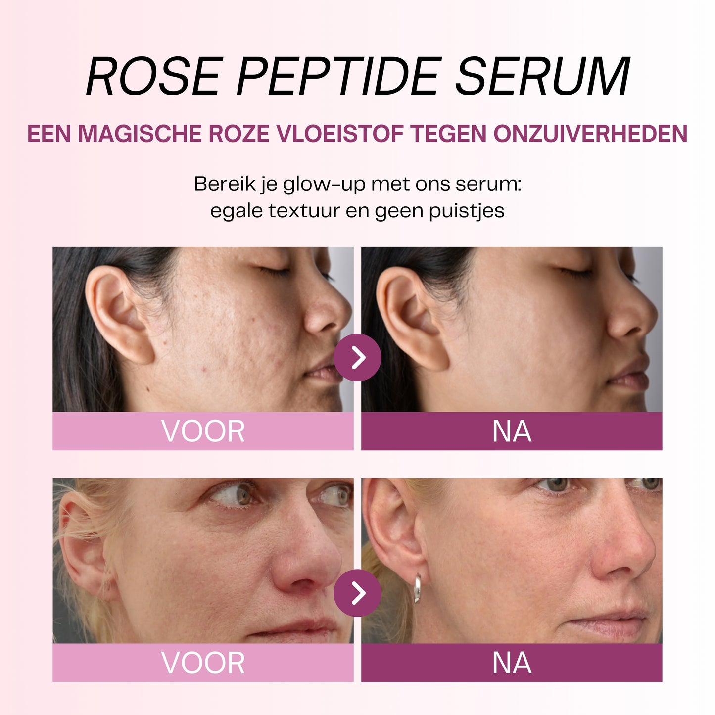 Rose Peptide Serum met PDRN