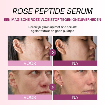 Rose Peptide Serum met PDRN