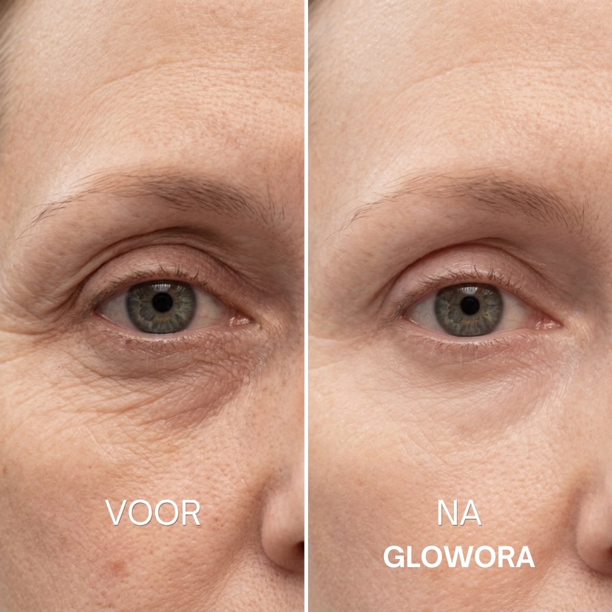 Voor en na Glowora