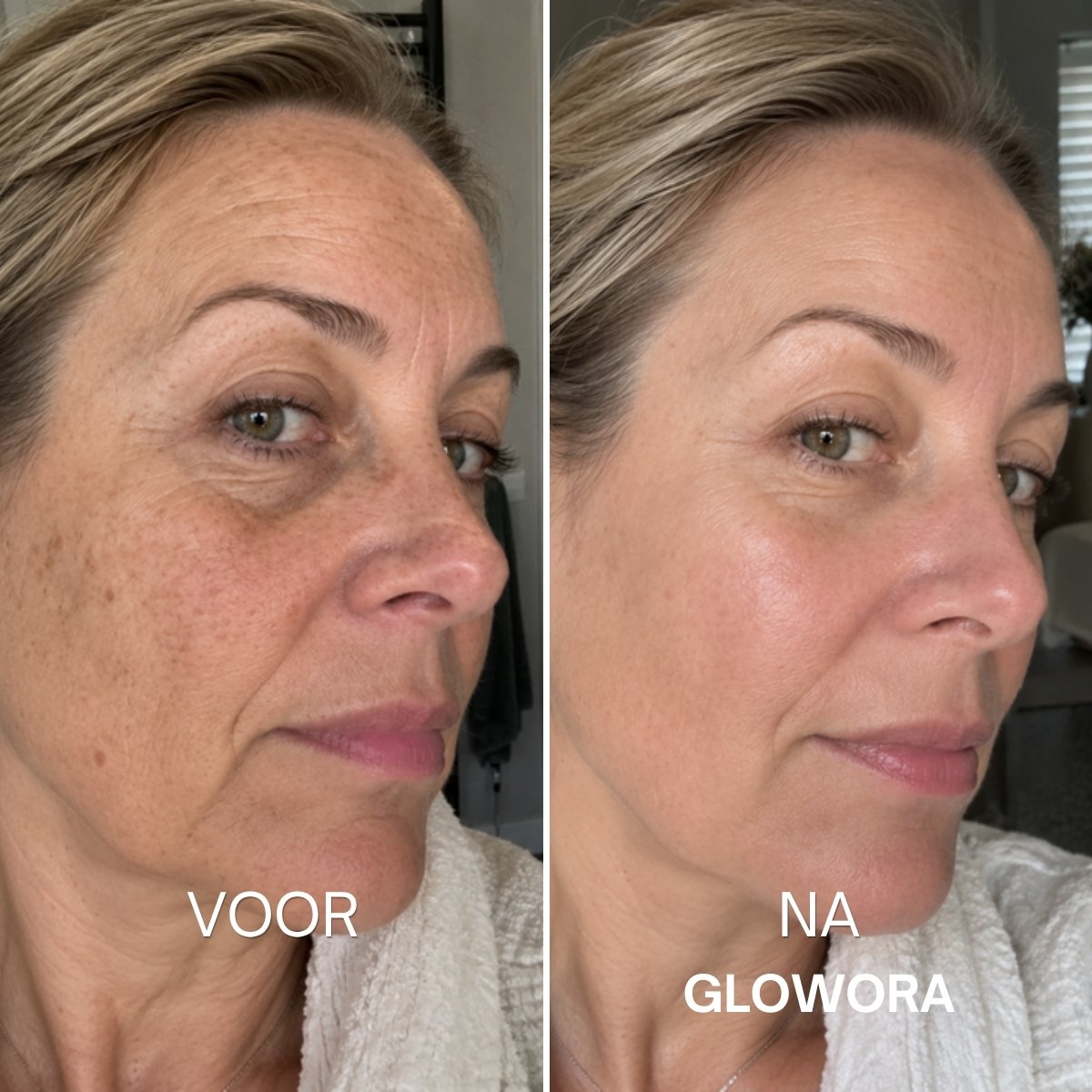 Voor en na Glowora