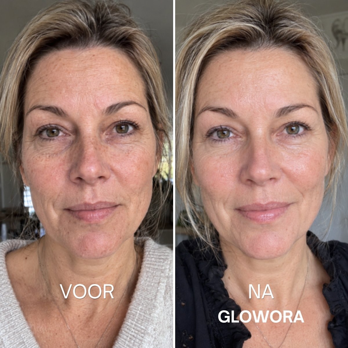 Voor en na Glowora