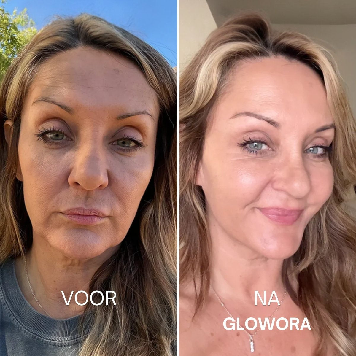 Voor en na Glowora