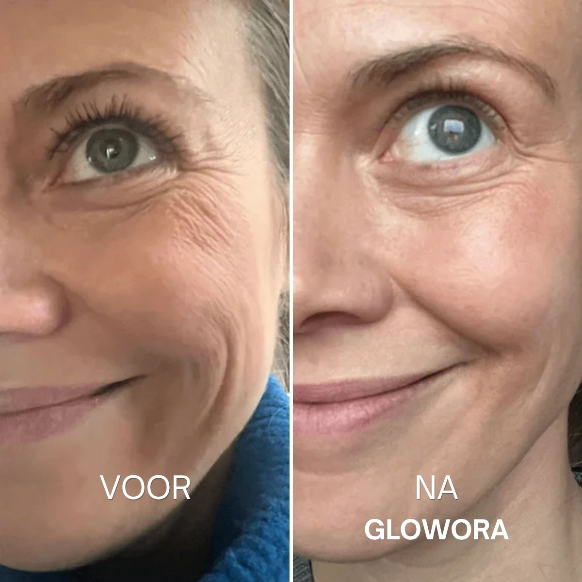 Voor en na Glowora