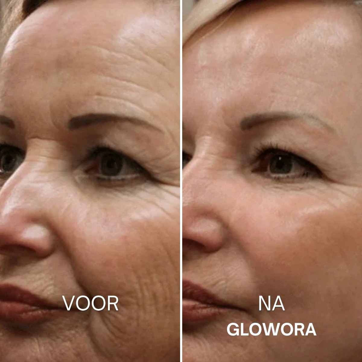 Voor en na Glowora