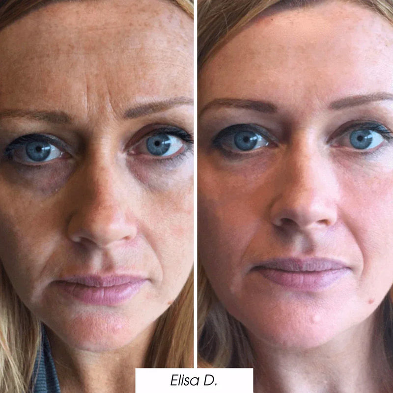 prima_dopo_maschera11.webp__PID:d1b9888d-4c83-462e-8a22-cfb7e2148455