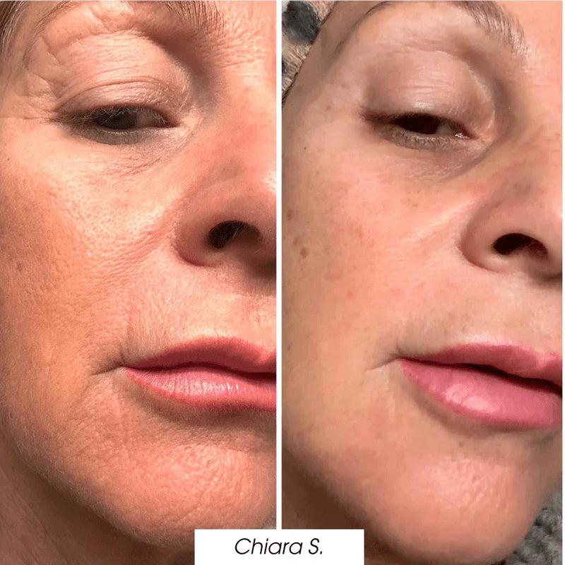 prima_dopo_maschera4.webp__PID:83162e4a-22cf-47e2-9484-55214587e679